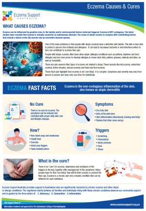 007 Esa Support Sheet Eczema Causes Cures