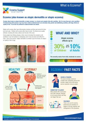 006 Esa Support Sheet What Is Eczema Page 001