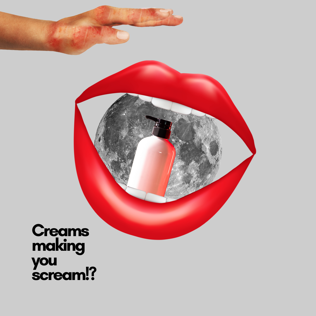 steroid cream for eczema