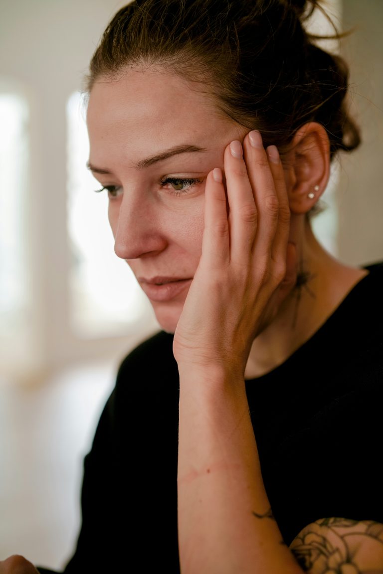 woman with topical steroid withdrawal