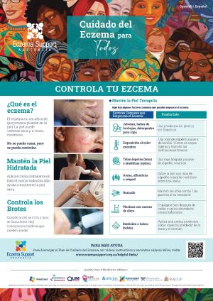 Cald Community Esa A3 Poster Spanish