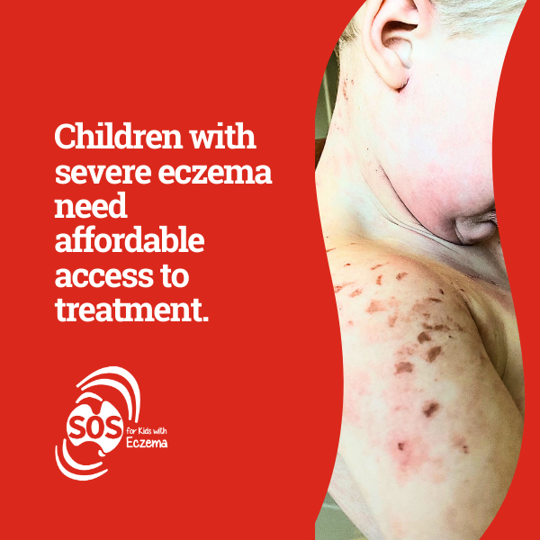 Eczema Support Australia Sos Campaign Thumbnail Blogmelaniefunk 2