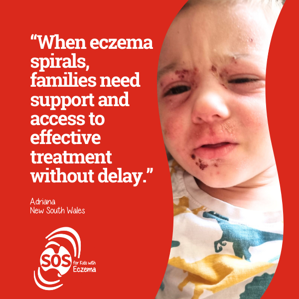 Eczema Support Australia Sos Campaign Thumbnail Blogmelaniefunk3