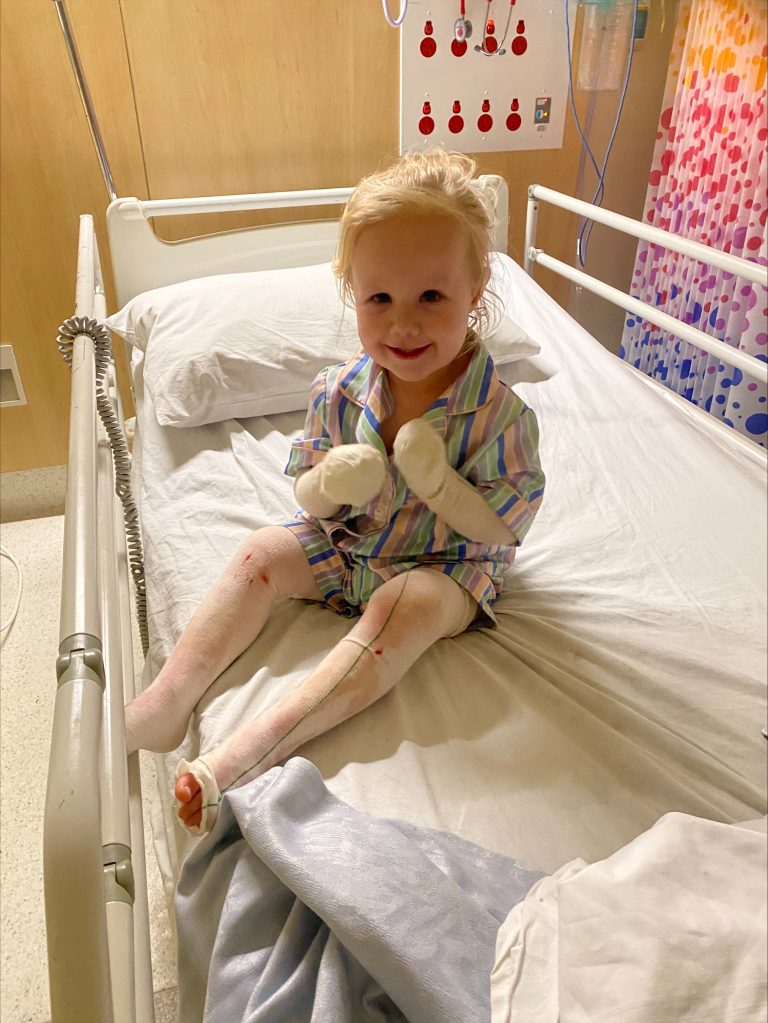 Lylah In Hospital With Severe Eczema 1