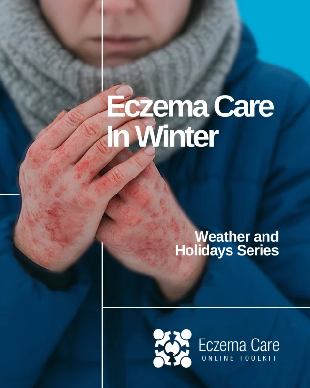❄️ It’s cold out there! 🧤🧣 
This month we’ll be sharing helpful tips to stay warm and keep caring for your eczema 💙 

How are you keeping warm? 🧥 

#eczemawintercare #eczemasupportaustralia #eczema