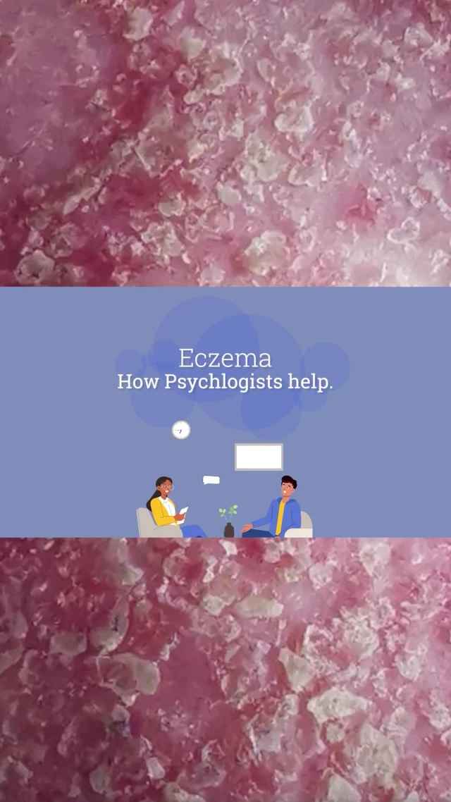 🙏💙 Thank you, Axis Clinic - one of our professional partners! 
For the past 6 years, we’ve worked together to develop psychological support resources for Australians living with eczema 🤝🧠✨ 
If you or any you know is living with eczema and needs help, sign up for our FREE psychological support: 
🔗 link in stories
#eczemasupportaustralia #eczema #eczemawellbeing #psychology #eczema #mentalhealth