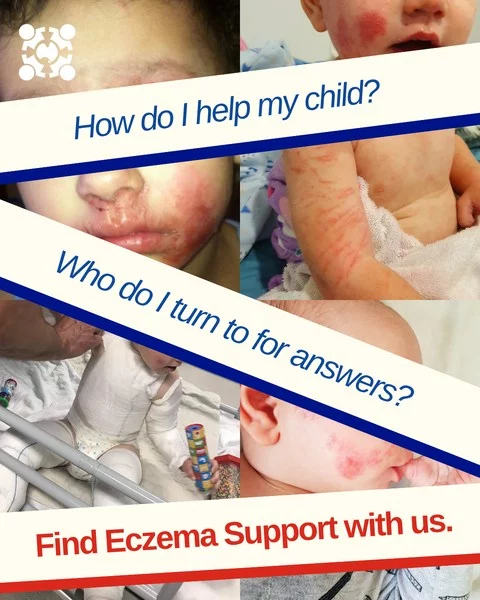 💭 What is eczema? 
👶🏽 How can I care for my child? 
💙 How do I look after myself? 

You're not alone — we're here to help.