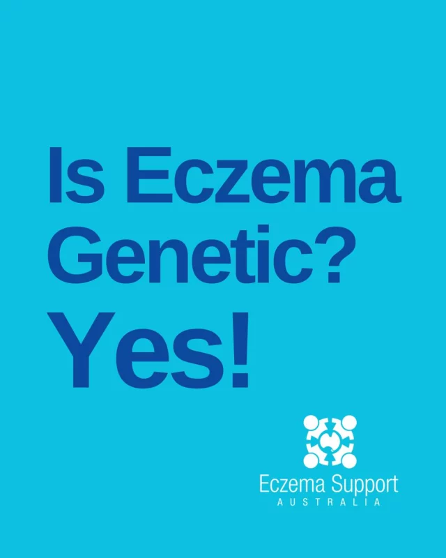 👖💙 Jeans for Genes Day 💙👖 

At Eczema Support Australia, we stand with our community in recognising the important role genetics can play in health conditions like eczema. 

Eczema is a complex, lifelong condition influenced by a mix of genetic, immune, environmental, and skin barrier factors — it’s not just one thing that can be “fixed.” 

#JeansForGenes #EczemaSupportAustralia #EczemaAwareness #YouAreNotAlone #ConnectInformAdvocate #EczemaCommunity #GeneticAwareness