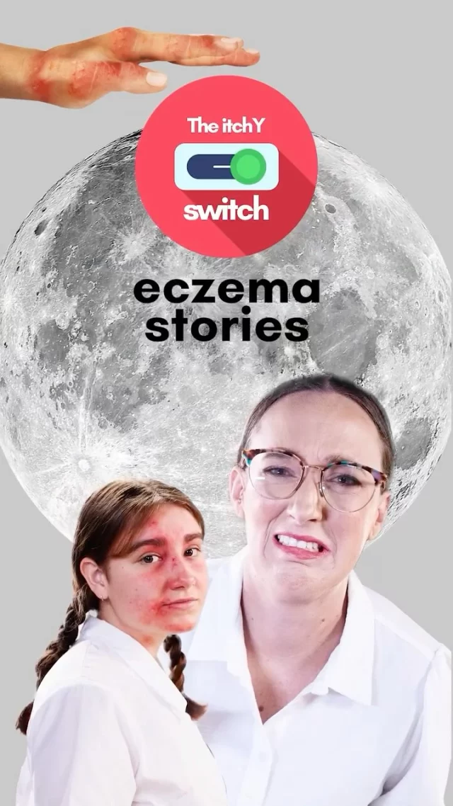 🎉 Happy International Youth Day! 💙 

Do you support a teen or young adult living with eczema? 

 We know those years can be tough — socially, emotionally, and physically. 

The Itchy Switch is a dedicated online video series, made with teens, for teens navigating life with eczema. 

👉 Explore the resource or share it with a young person today: 
link in stories

#InternationalYouthDay #EczemaSupportAustralia #TheItchySwitch #TeenEczema #YouAreNotAlone #EczemaAwareness #EczemaParentSupport #YoungAdultHealth