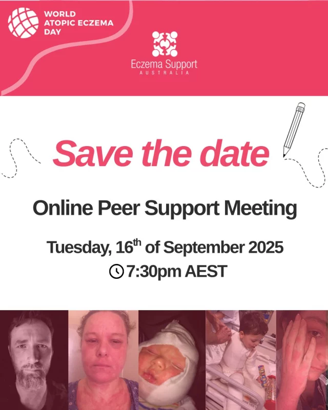 📆Save the Date -  for our Online Peer Support Meeting.

This is will be an online space to share, listen, and connect with others who truly understand. 

This meeting will not be recorded. 

#EczemaSupportAustralia #Eczema #AtopicEczemaDay #AtopicEczemaJourney