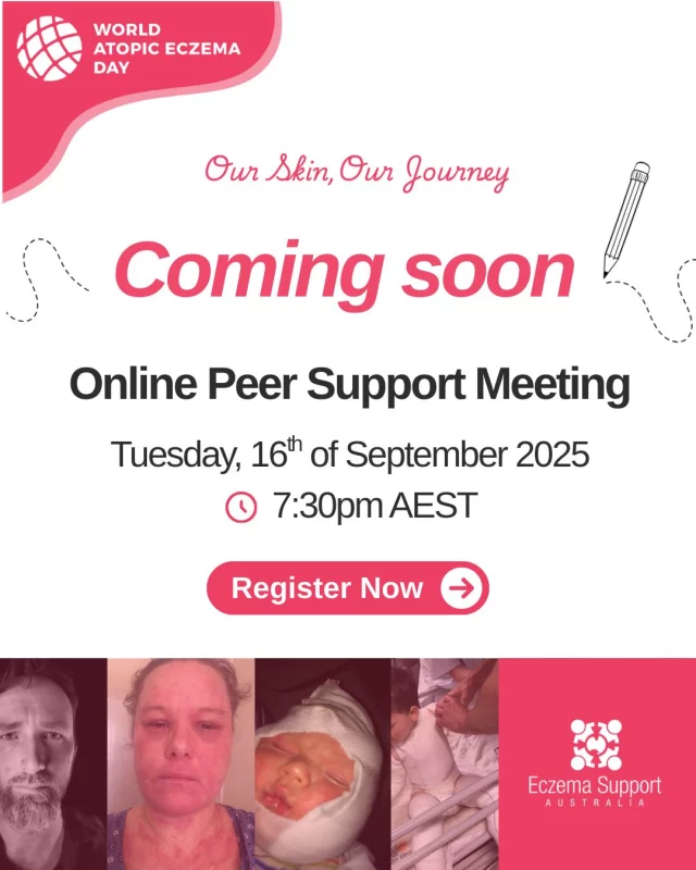 Please join us for our  Online Peer Support Meeting.

Living with eczema can be challenging. You don’t have to go through it alone. 

This online event is a space to share, listen, and connect with others who truly understand. 

📅Date: Tuesday – 16th September 
🕖Time:  7:30pm – 8:30pm AEST 
💻Location: Online 
👫Suitable for: Parents or carers of a baby or young child or teen. Teens and adults living with eczema. Health professionals with eczema patients. 

Register via our link in our stories or comment "CONNECT" and we will DM you a link. 

#EczemaSupportAustralia #Eczema #AtopicEczemaDay #AtopicEczemaJourney #OurSkinOurJourney