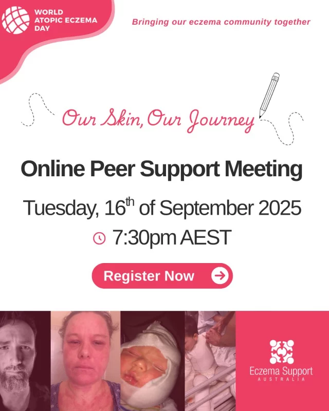 This online event is a space to share, listen, and connect with others who truly understand. 
 
👫Suitable for: Parents or carers of a baby or young child or teen. Teens and adults living with eczema. Health professionals with eczema patients. 

Register here: ⤵️
click the link in our bio or comment "CONNECT" and we will send a link via a DM.😊

 #Eczema Support Australia #Eczema #AtopicEczemaDay #AtopicEczemaJourney